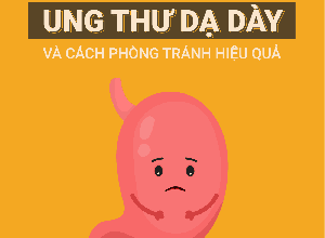 Ung thư dạ dày: Làm sao để nhận biết sớm các triệu chứng?